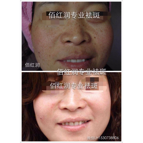 前后对比照